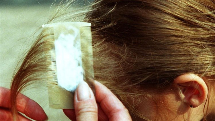 Läusekamm Läusekamm