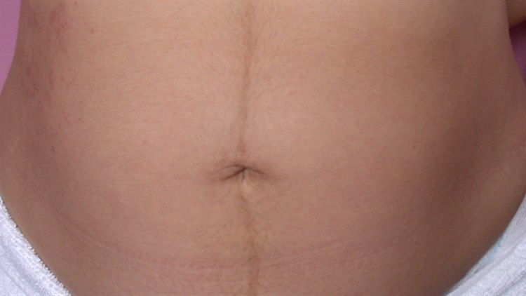 Linea nigra 10359-2-linea-nigra.jpg