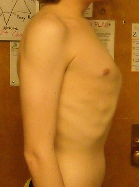 Kielbrust Kielbrust (002).jpg