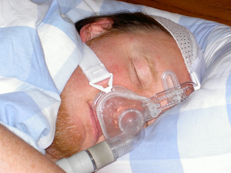 Anwendung einer CPAP-Nasenmaske (Quelle: Wikimedia Commons https://commons.wikimedia.org/wiki/File:Cpapanwender.jpg) Cpapanwender.jpg