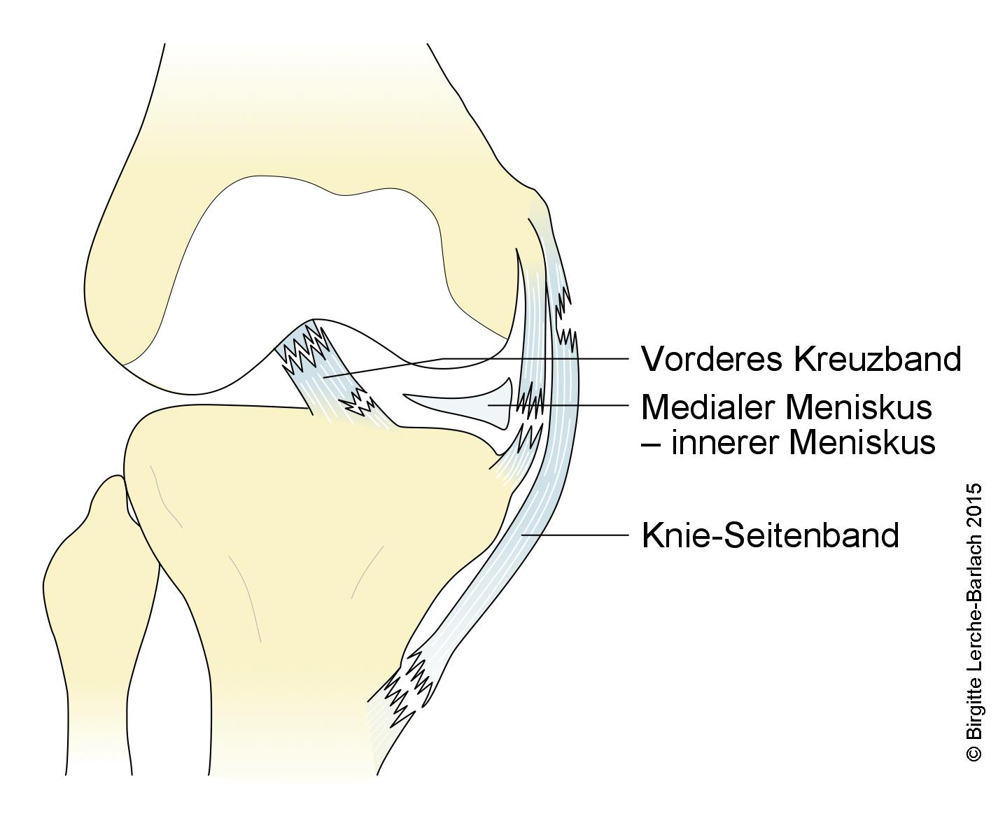 Knie: Läsion an Bändern, Kreuzband und Meniskus Knie: Läsion an Bändern, Kreuzband und Meniskus