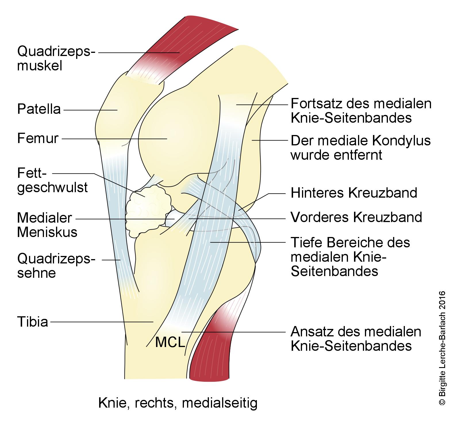 Knie, rechts, medialseitig.jpg Knie, rechts, medialseitig.jpg