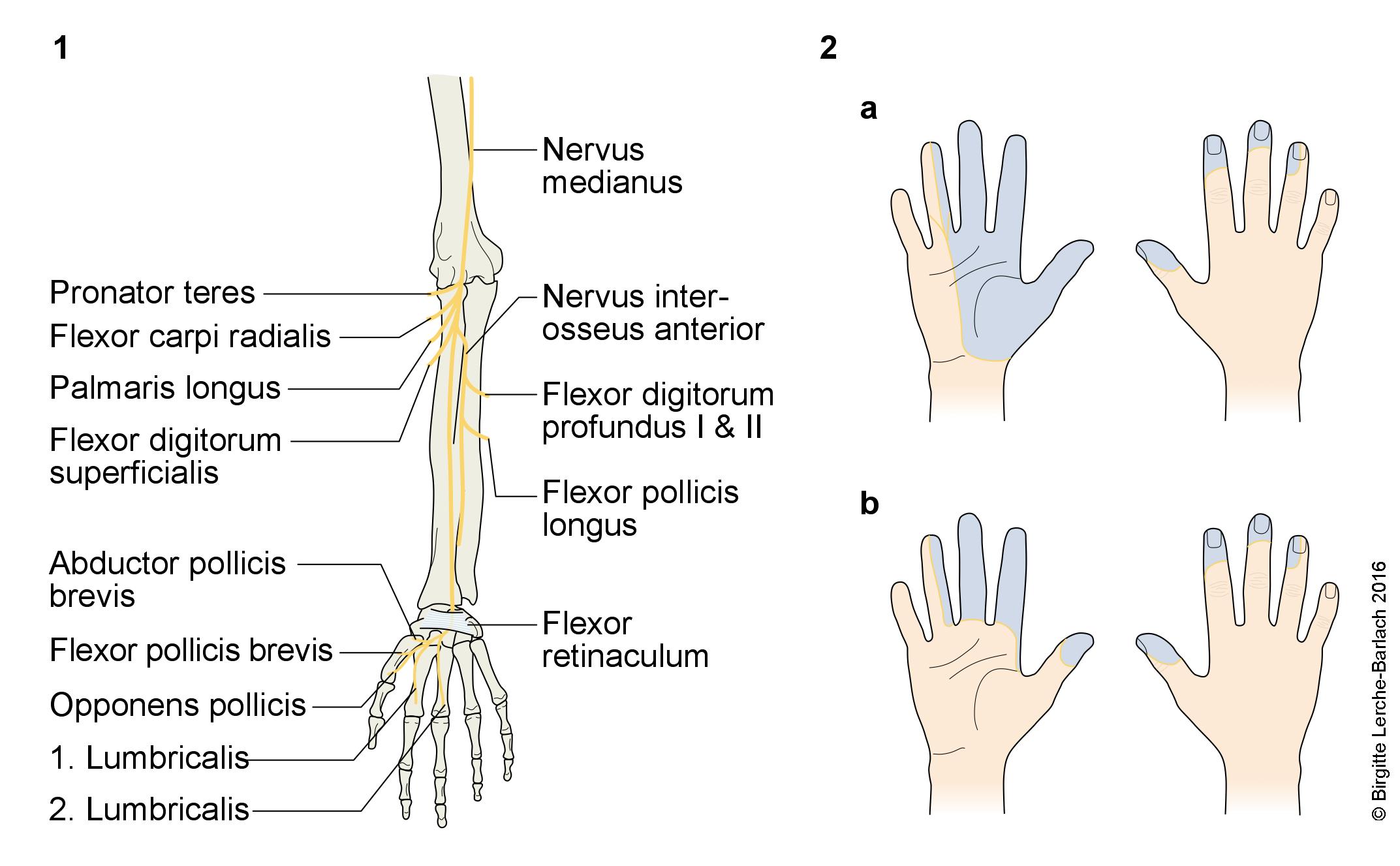 Versorgungsgebiet und Verlauf des Nervus medianus Nervus medianus.jpg