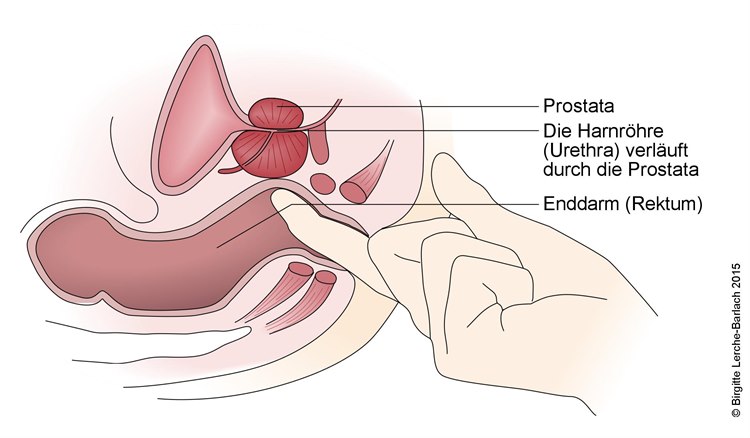 Untersuchung der Prostata Untersuchung der Prostata