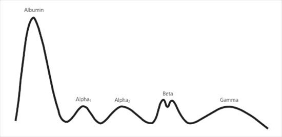 Elektrophorese, Normalbefund 1470-2-serumproteinelektroforese-normal.jpg